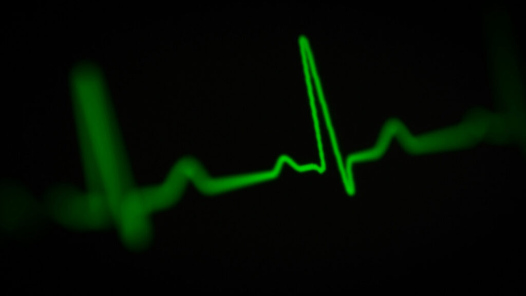 Can You Play Sports With a Heart Murmur A Complete Guide to Safe Physical Activity | AED Brand Review